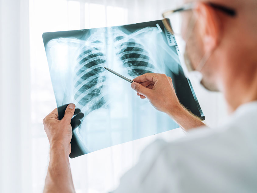 A health professional looking at a x-ray of lungs